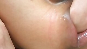 The anus is attracted.